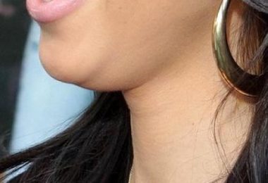 Mujer con papada