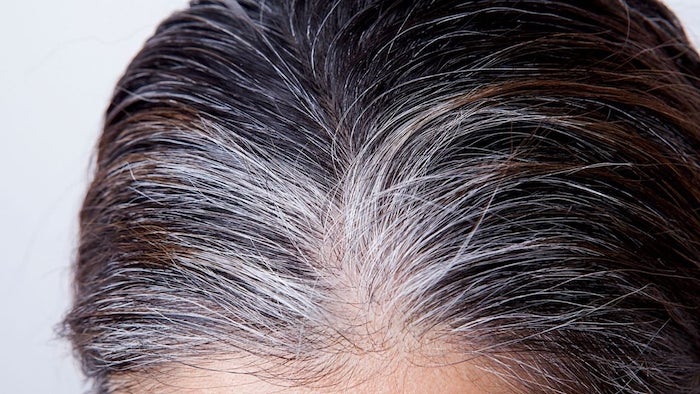 Canas prematuras por deficiencias nutricionales